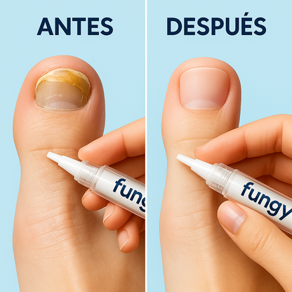 Fungy Pen™ Lapiz Anti Hongos